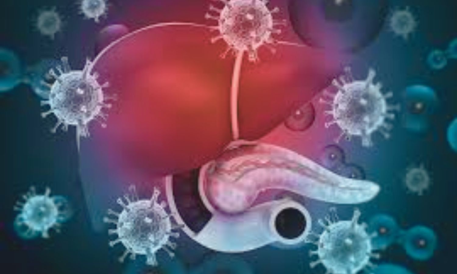 Severe Alcohol-Associated Hepatitis Still Carries High Short-Term Mortality, Meta-Analysis Finds