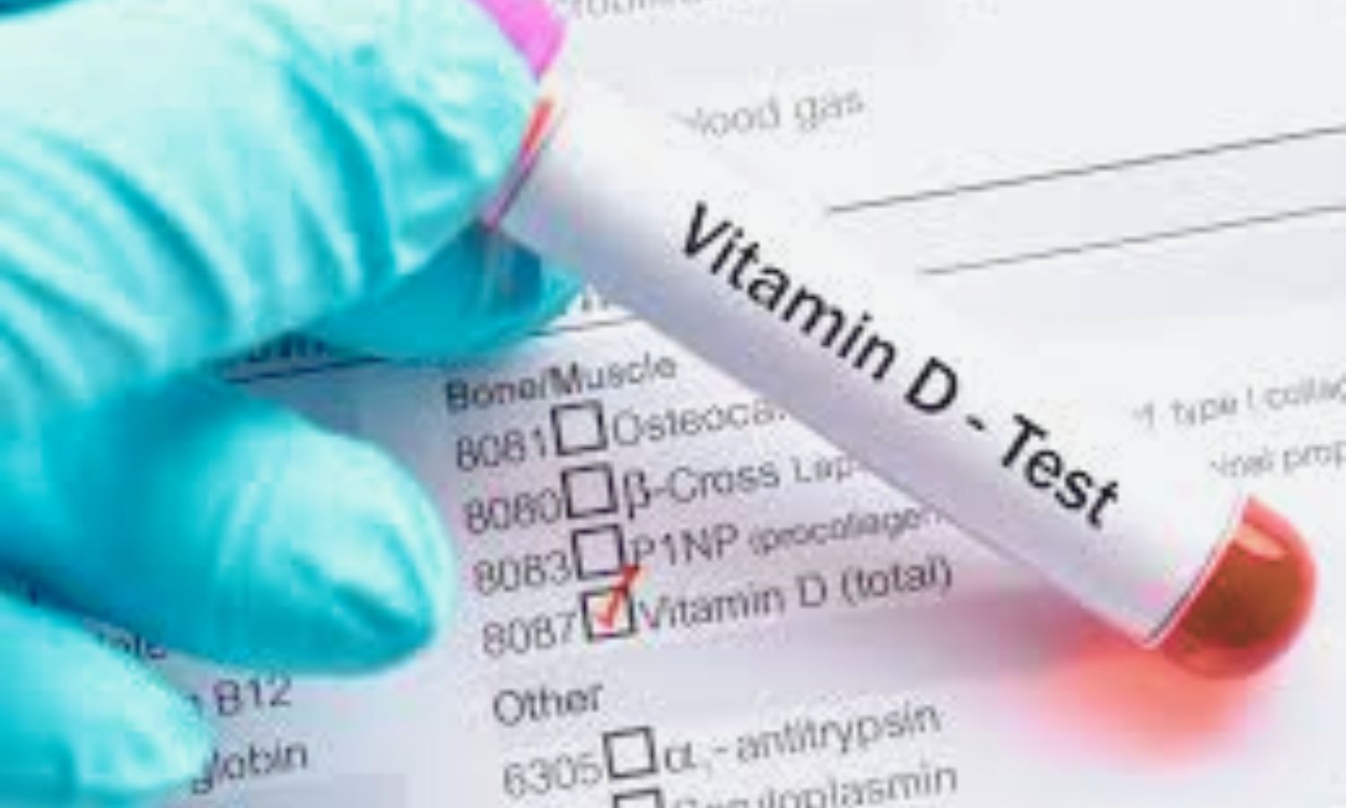 Higher Vitamin D Levels Lowers Dementia Risk, Finds Frontiers Study