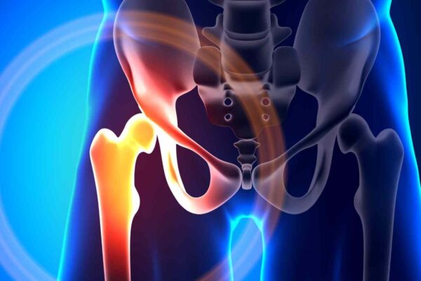 Family History of Fracture Significantly Raises Future Fracture Risk: Meta-Analysis Finds
