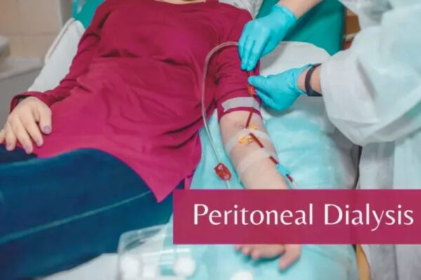 Validated nomogram may Predict upper GI bleeding in peritoneal dialysis Patients: Study