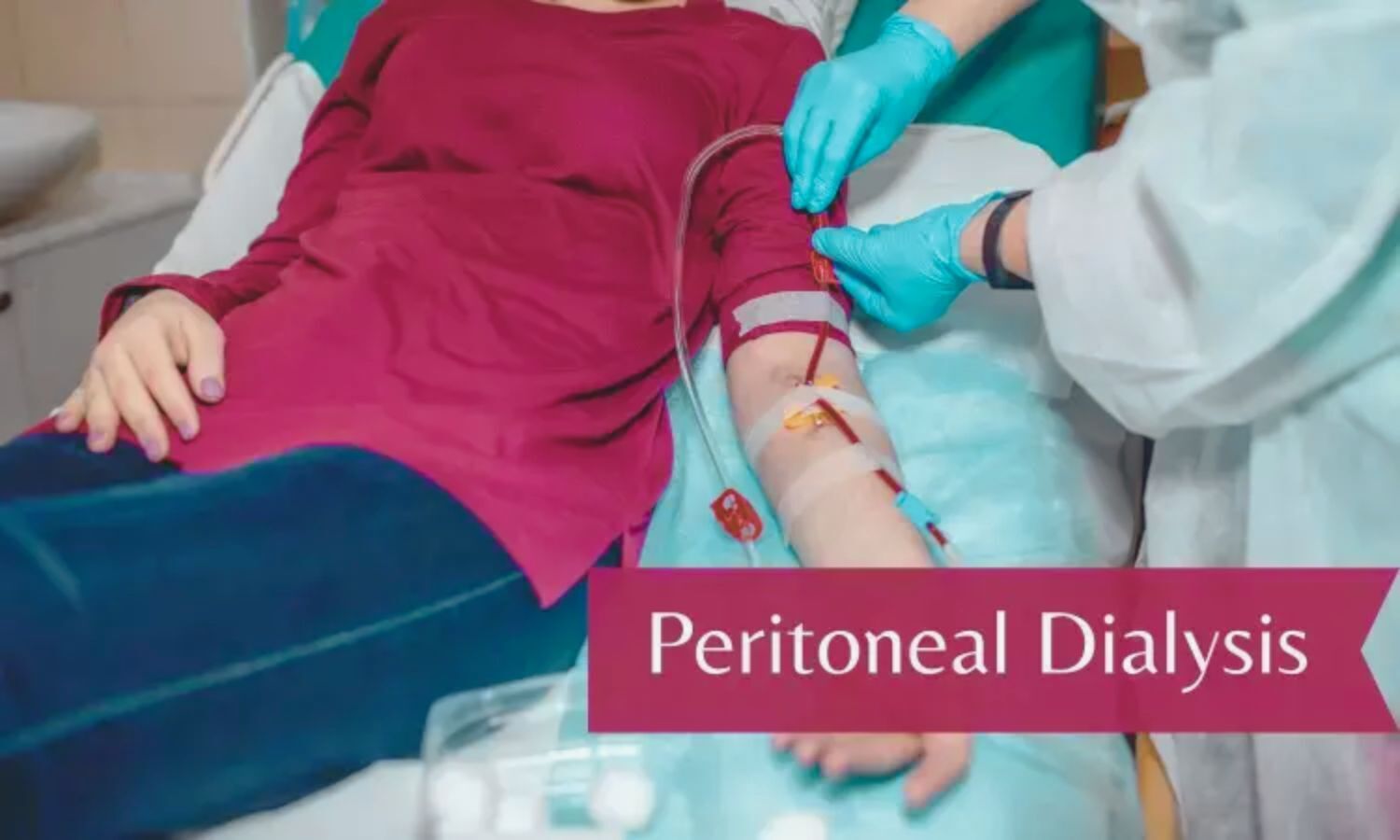 Validated nomogram may Predict upper GI bleeding in peritoneal dialysis Patients: Study