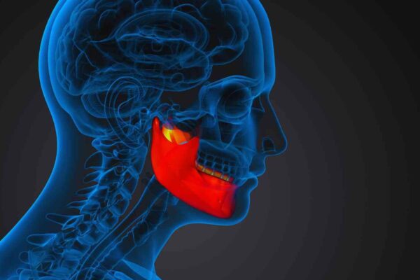 Can botox be used to alleviate pain in a jaw disorder?