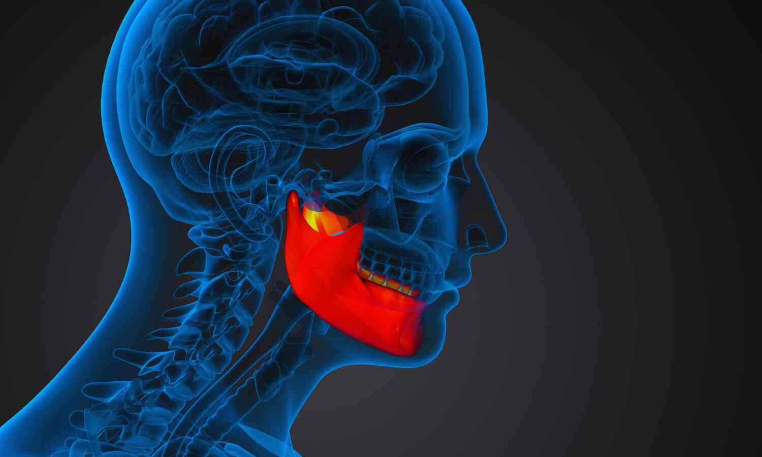 Can botox be used to alleviate pain in a jaw disorder?