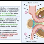 Lower Irisin Levels Linked to Diabetic Nephropathy Progression in T2DM: Study