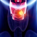 AI could soon detect early voice box cancer from the sound of your voice, suggests study