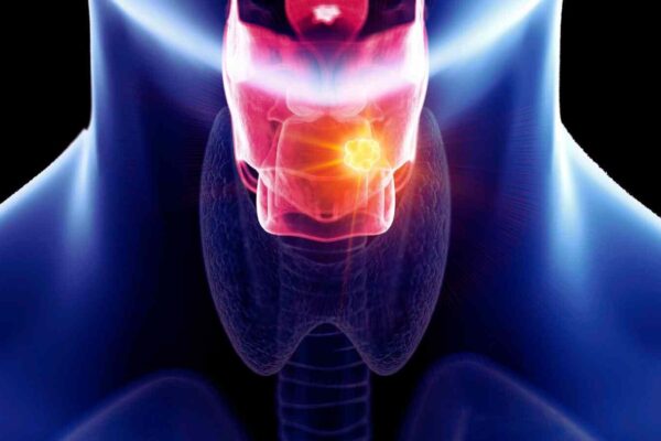 AI could soon detect early voice box cancer from the sound of your voice, suggests study