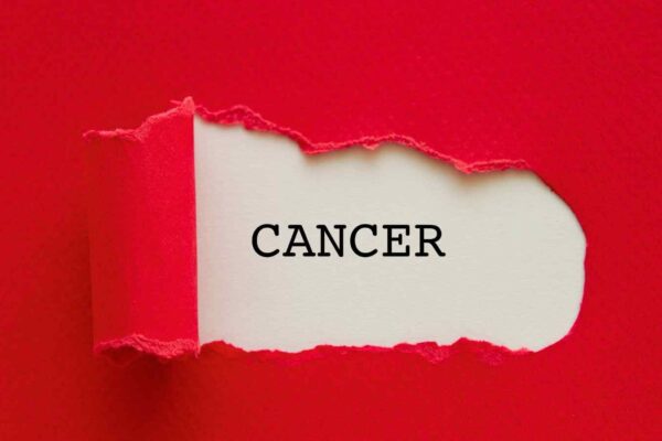 High protein or Trp diet increases risk of cancer-associated VTE: Study
