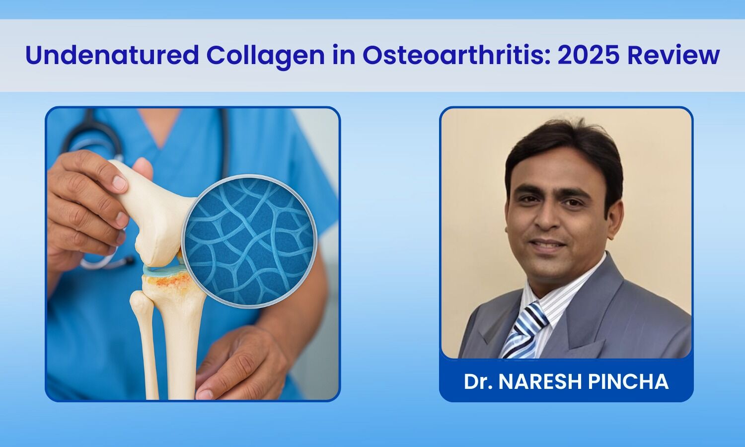 Undenatured Collagen in Osteoarthritis Management: Practitioner’s Review in 2025
