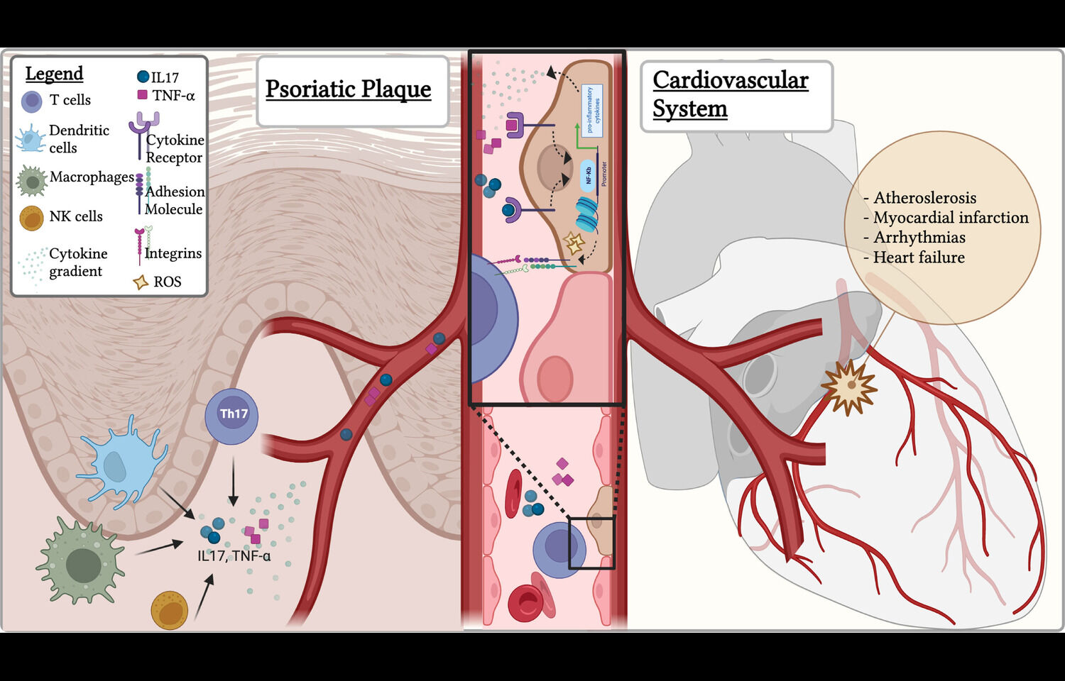 Methotrexate and TNF Inhibitors Linked to Lowest Cardiovascular Risk in Psoriasis: Study