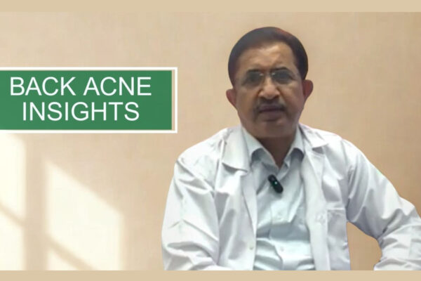 Mistakes and Management by Dermatologist Dr. B.S. Chandrashekar Mistakes and Management by Dermatologist Dr. B.S. Chandrashekar