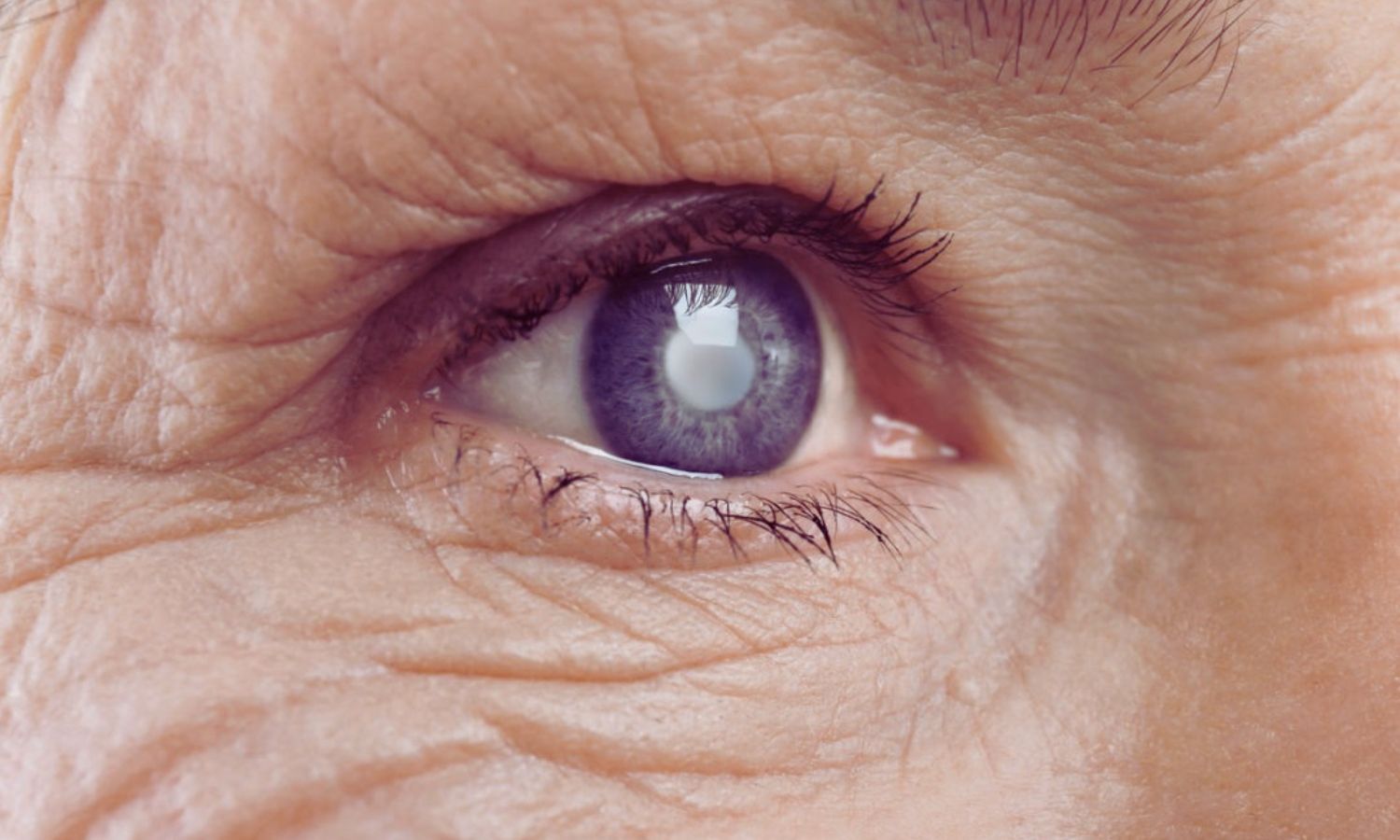 New Lens Implant After Cataract Surgery Restores Clear Vision Across All Distances Without Glasses: Study