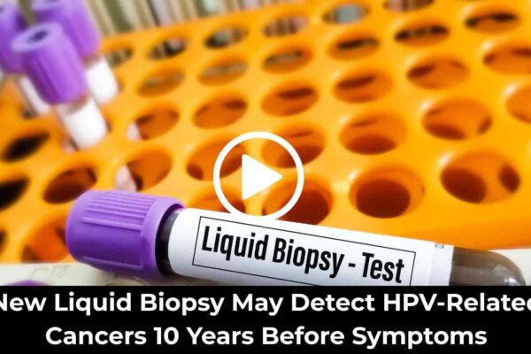 New Liquid Biopsy May Detect HPV-Related Cancers 10 Years Before Symptoms: Study Finds