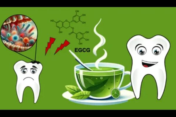 Matcha Tea as Adjuvant Therapy Improves Gingival Health, suggests study