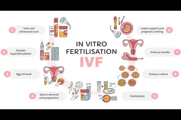 TyG-BMI may predict Adverse Pregnancy Outcomes in IVF, suggests research