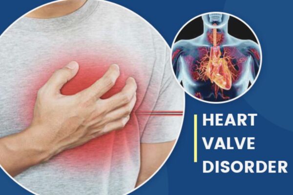 2025 ESC/EACTS Valvular Heart Disease Guidelines Stress Heart Team, Advanced Imaging
