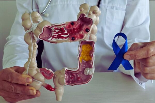 PET/MRI Outperforms Standard Imaging in Rectal Cancer Staging, Study Shows