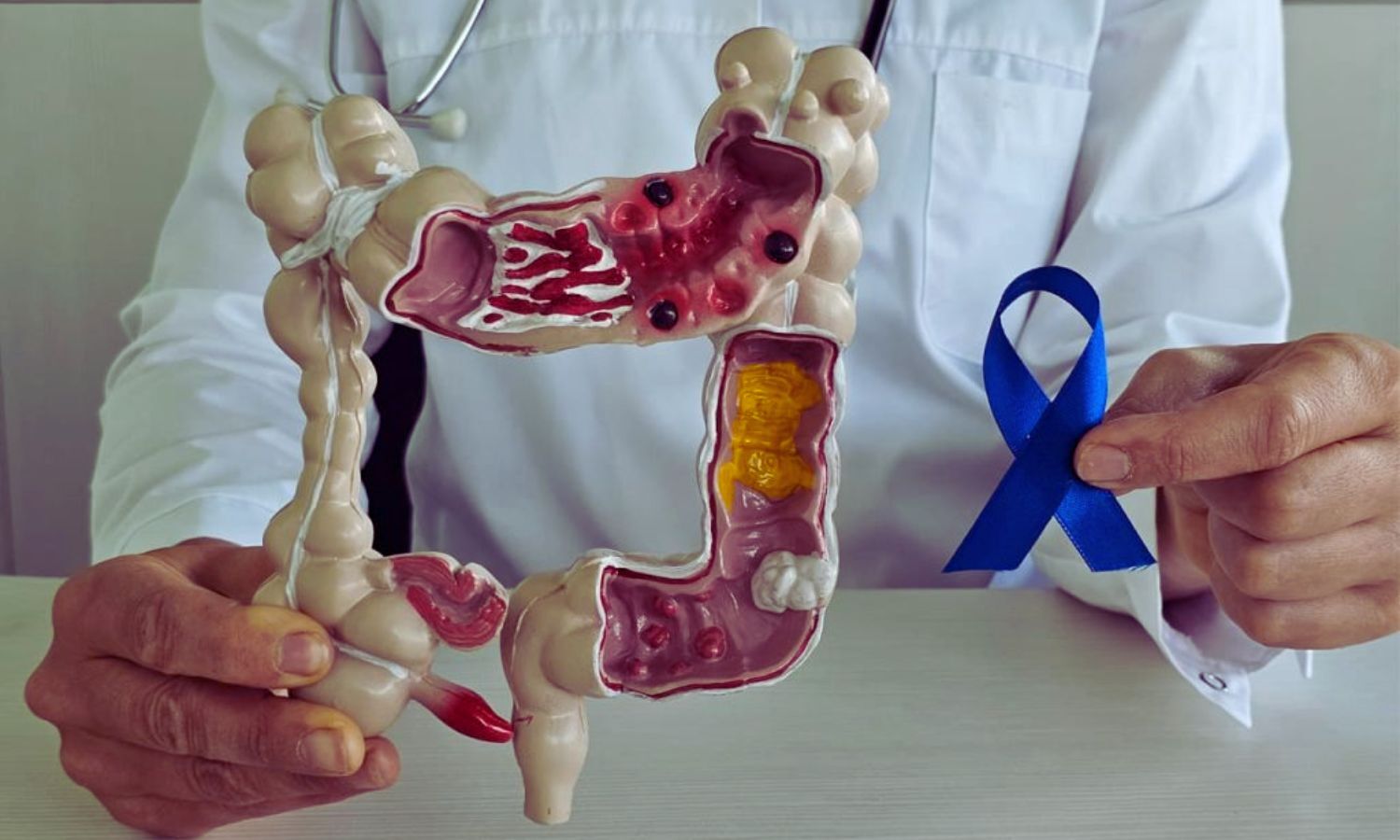 PET/MRI Outperforms Standard Imaging in Rectal Cancer Staging, Study Shows