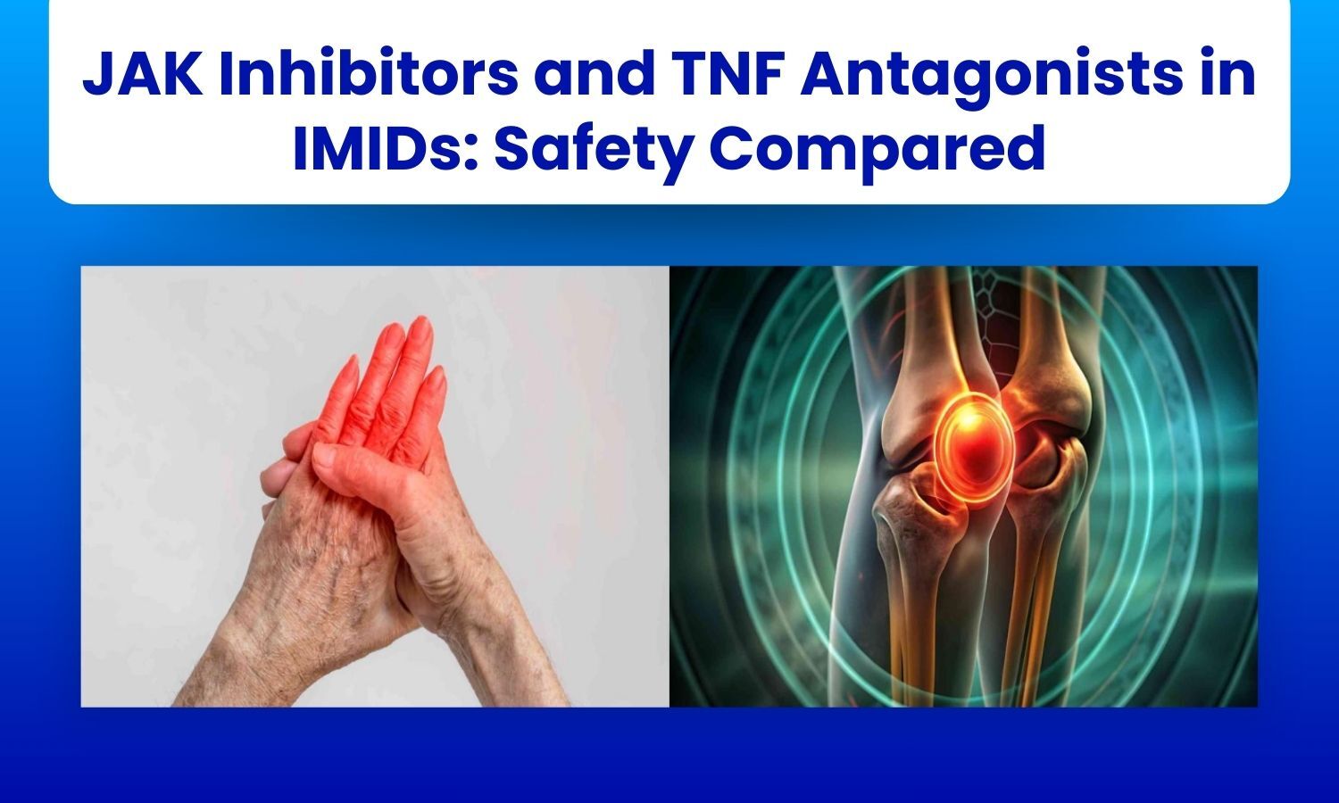Meta-Analysis Finds Comparable Safety Profiles for JAK Inhibitors and TNF Antagonists in Immune Mediated Inflammatory Diseases