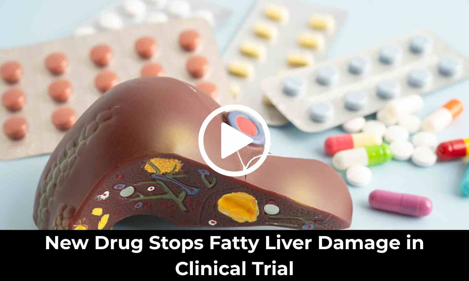 New Drug Stops Fatty Liver Damage in Clinical Trial