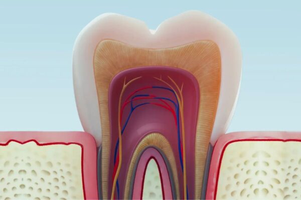 1 Percent Phytic Acid useful Alternative to 17 Percent EDTA for Root Canal Irrigation: Study Suggests