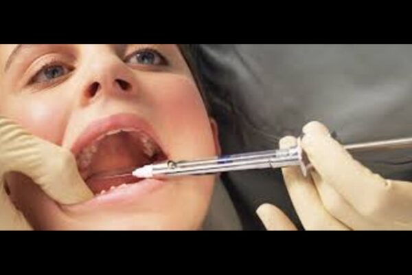 Sweet Vanilla Scent Reduces Injection Pain during anesthesia for maxillary molars in Children: Study Sweet Vanilla Scent Reduces Injection Pain during anesthesia for maxillary molars in Children: Study