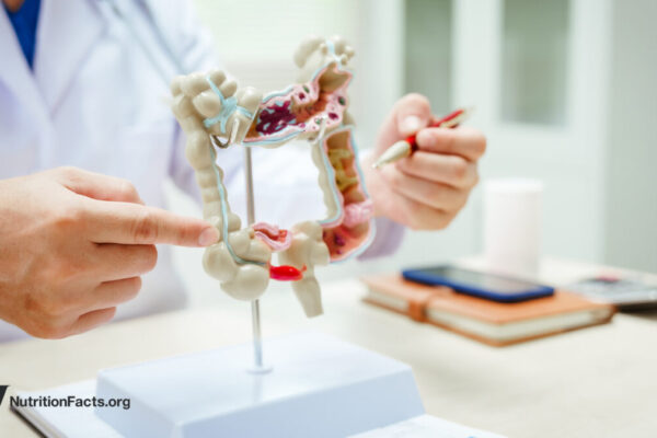 The Validity of SIBO Tests 