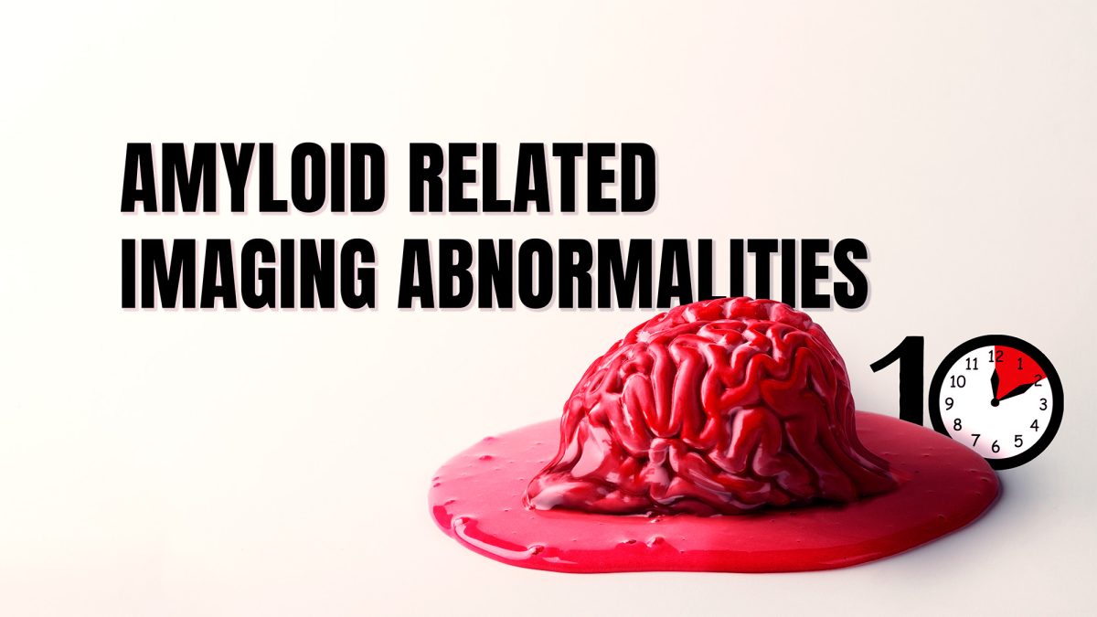 Amyloid-related imaging abnormalities: an emergency medicine nightmare?