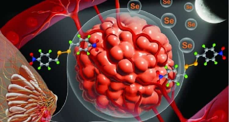 IASST and IIT Guwahati develop novel organoselenium compound to combat triple-negative breast cancer