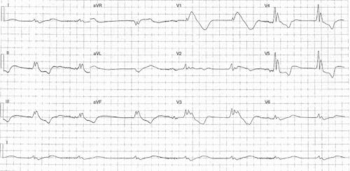 ECG of the Week 22nd September 2021