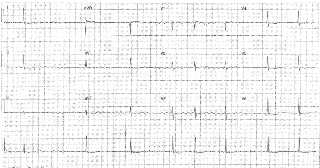 ECG of the Week – 29th September 2021 – Interpretation