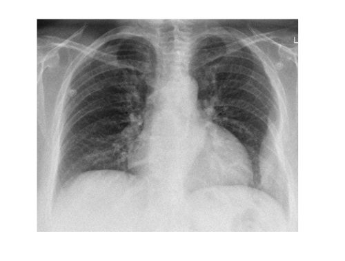 Imaging Case of the Week 479