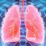 Global Summit on Respiratory Health