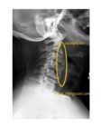 Imaging Case of the Week 404 Answer