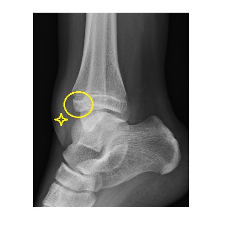 Imaging Case of the Week 481 Answer