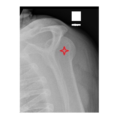 Imaging Case of the Week 482 Answer