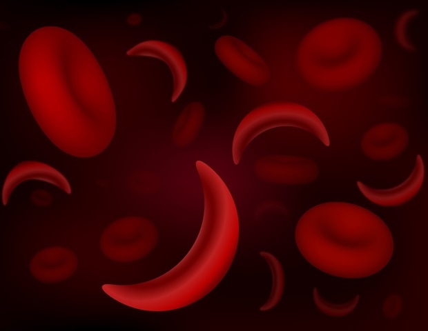 Timely opioid treatment lowers hospitalizations in children with sickle cell disease