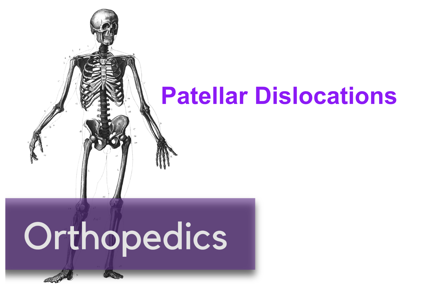 Patellar Dislocations — NUEM Blog