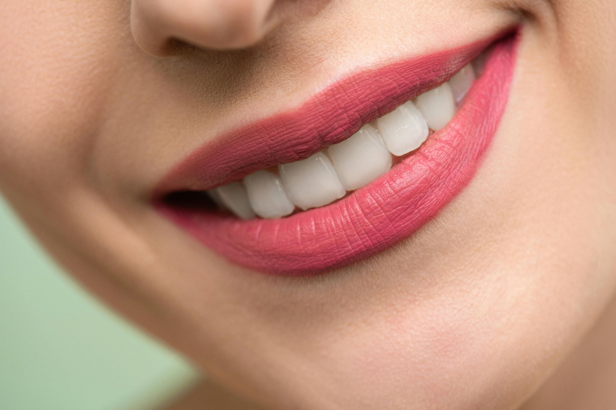 Teeth Whitening Singapore: A Simple Way to Brighten Your Smile