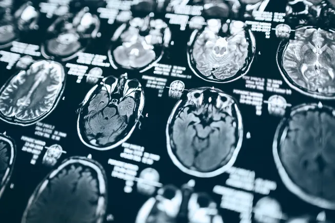 MapLight lines up an IPO in bid to challenge Bristol Myers schizophrenia drug