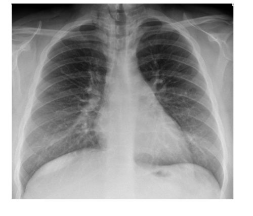 Imaging Case of the Week 469