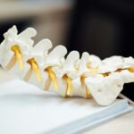 Biogen to acquire Alcyone Therapeutics for m