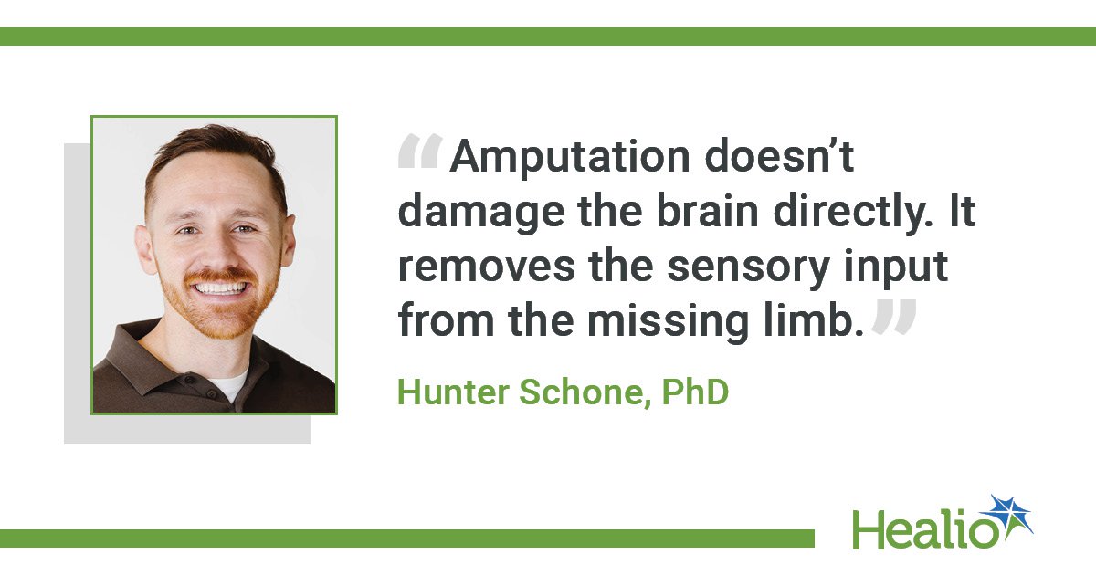 Investigating brain plasticity after limb amputation
