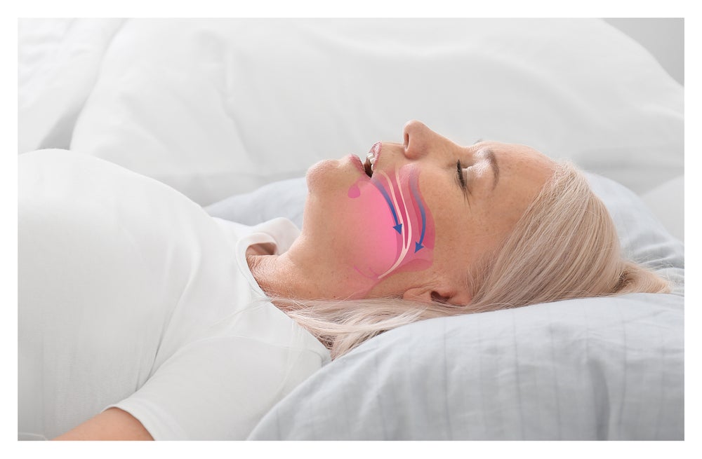 FDA gives first approval for recurrent respiratory papillomatosis