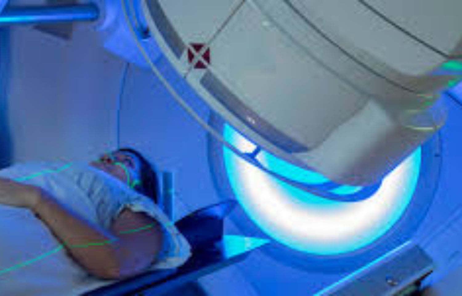 Radiation therapy after surgery safely reduces pelvic relapse risk from locally advanced, muscle-invasive bladder: cancer: Study