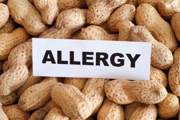 New tools boost pediatricians’ adherence to peanut allergy guidelines 15-fold