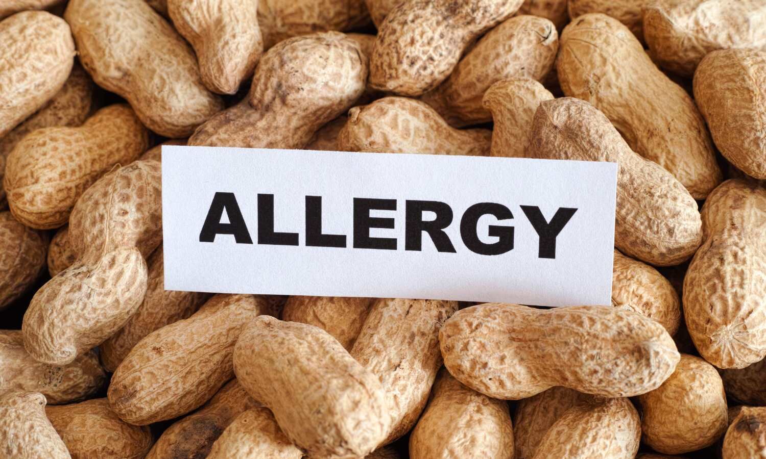 New tools boost pediatricians’ adherence to peanut allergy guidelines 15-fold