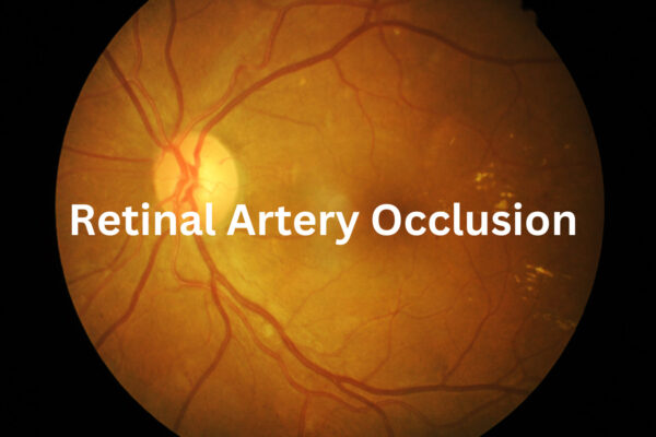 Retinal Artery Occlusion Significantly Increases Risk of Ischemic Stroke: Meta-Analysis Shows