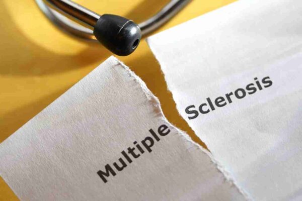 MS does not worsen menopause symptoms: study