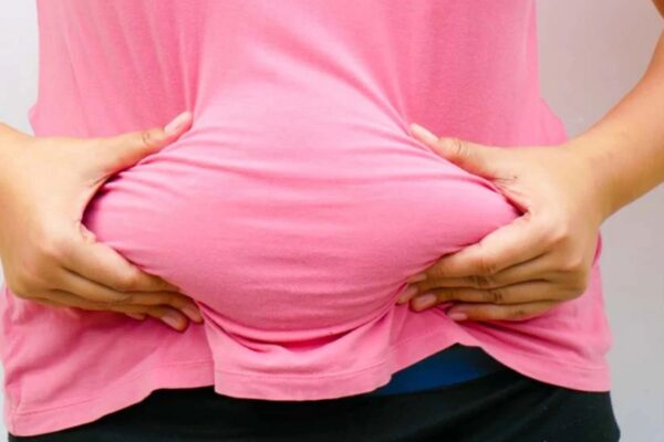 Visceral and Liver Fat Linked to Carotid Atherosclerosis, Suggests Research