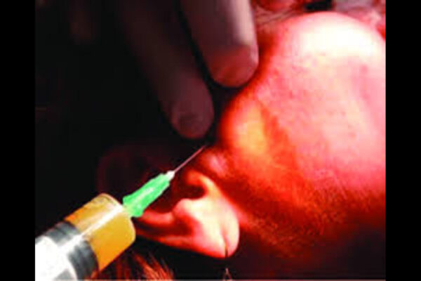 Individualized approach for intra-Articular Injections effective for TMJ Arthralgia, suggests study